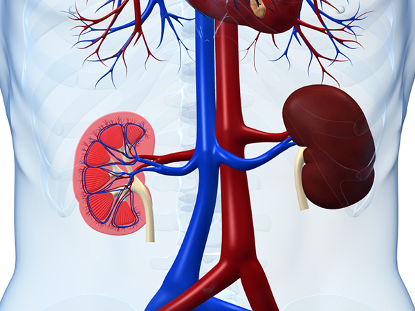 Kidney Disease and Diet